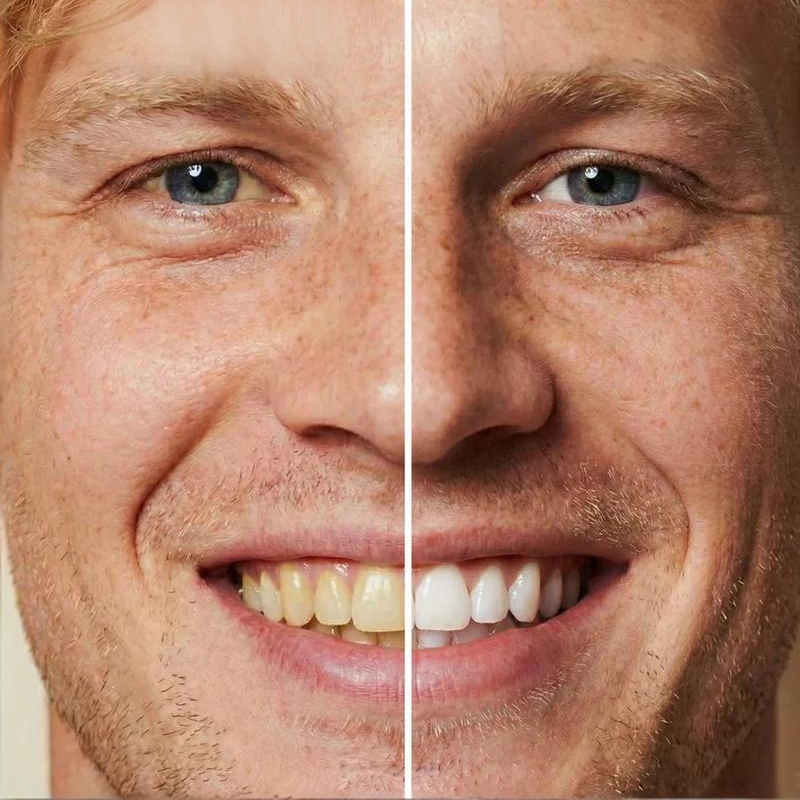 Instant Whitening Tooth Paint ✨ Made by Dentists Professional Teeth Whitening Formula