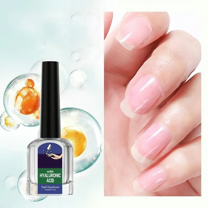 🎉Just Today Offer 60% Off 💖 Antifungal Nail Repair & High-Gloss Shine Solution, Salon-Perfect Results