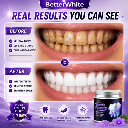 ⏰SUMMER SALE 60%🔥Advanced Teeth Whitening Powder – 2026 Expert-Formulated Whitening  Fomula